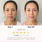 EuphSkin 7-in-1 LED Face Mask
