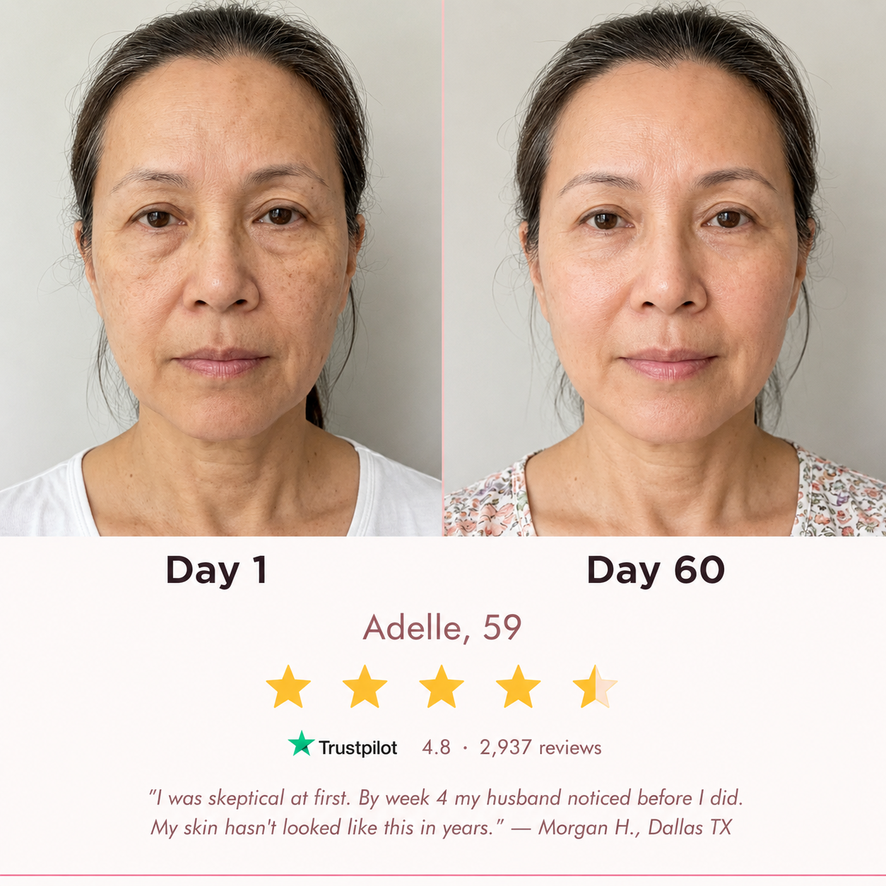 EuphSkin 7-in-1 LED Face Mask