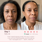 EuphSkin 7-in-1 LED Face Mask