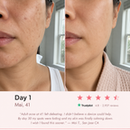 EuphSkin 7-in-1 LED Face Mask