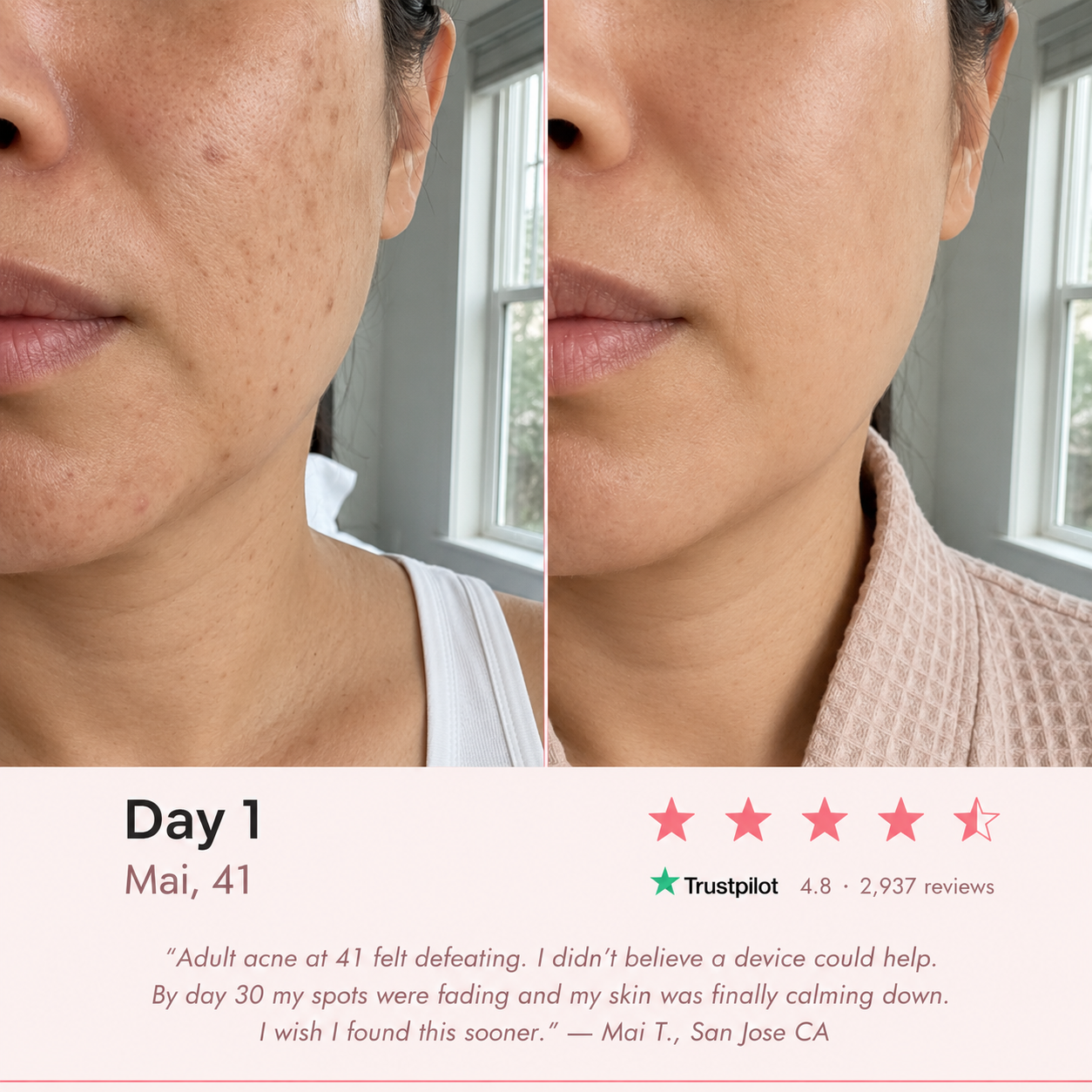 EuphSkin 7-in-1 LED Face Mask