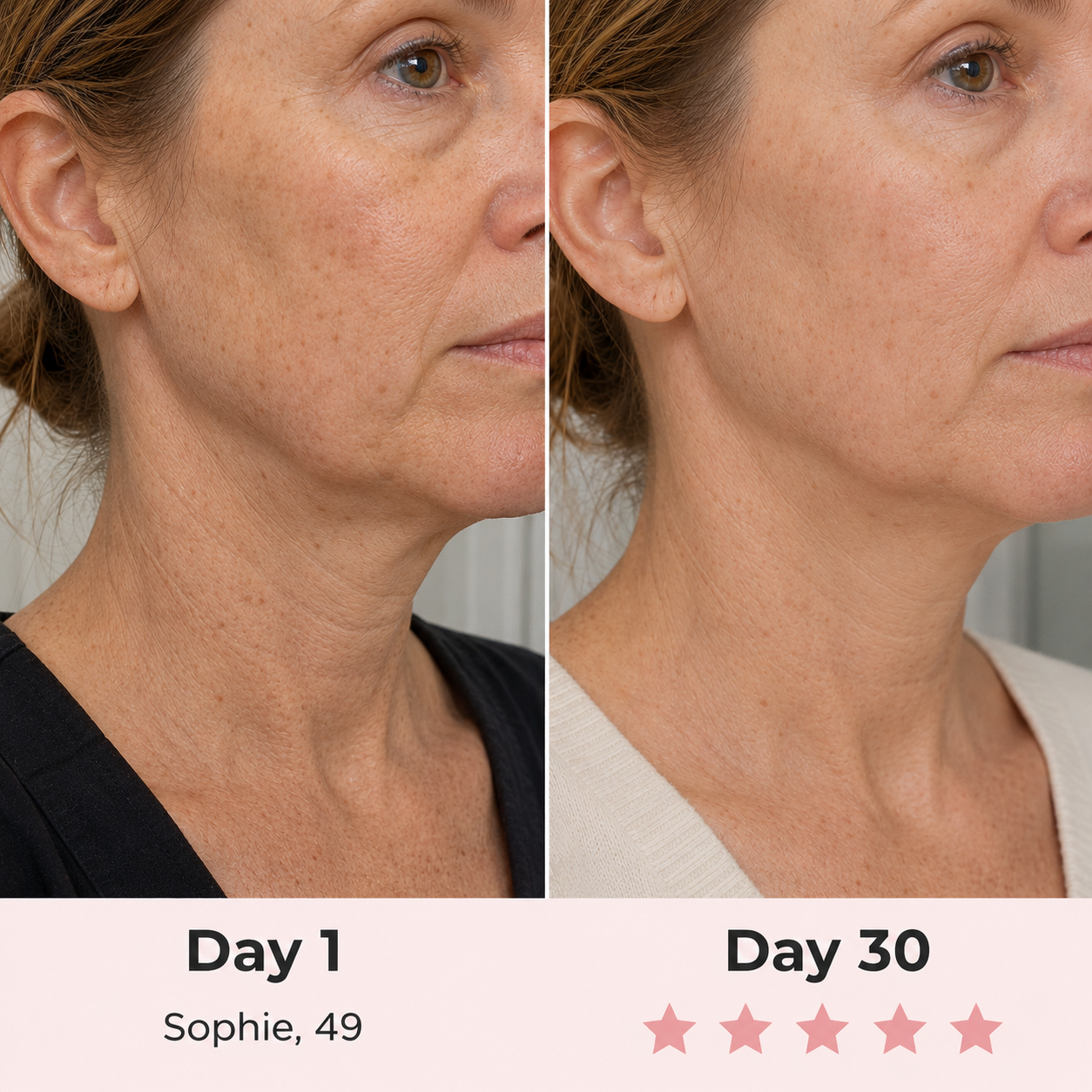 EuphSkin Sculpt Face