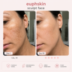 EuphSkin Sculpt Face