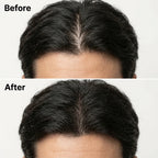 EuphScalp Korean Treatment Bar Men