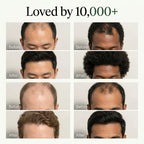 EuphScalp Korean Treatment Bar Men